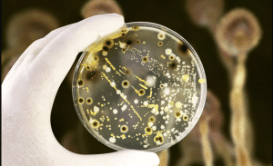 How to Detox Your Body From Mold