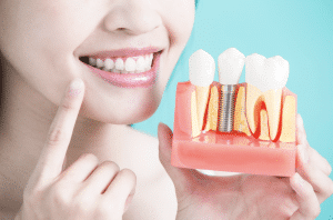 how much do dental implants cost