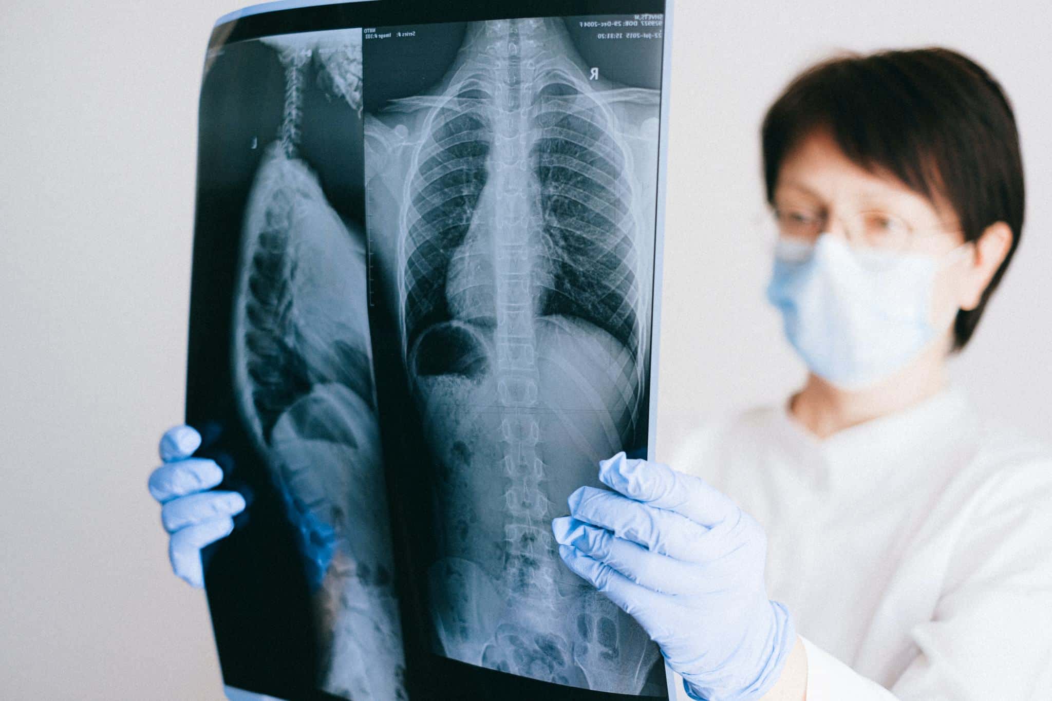 What are Lung Tests and Why Are They Important