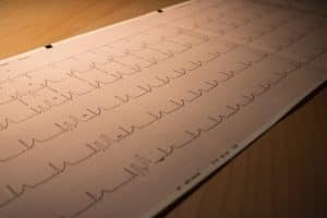 ECG vs EKG - What's the Difference?