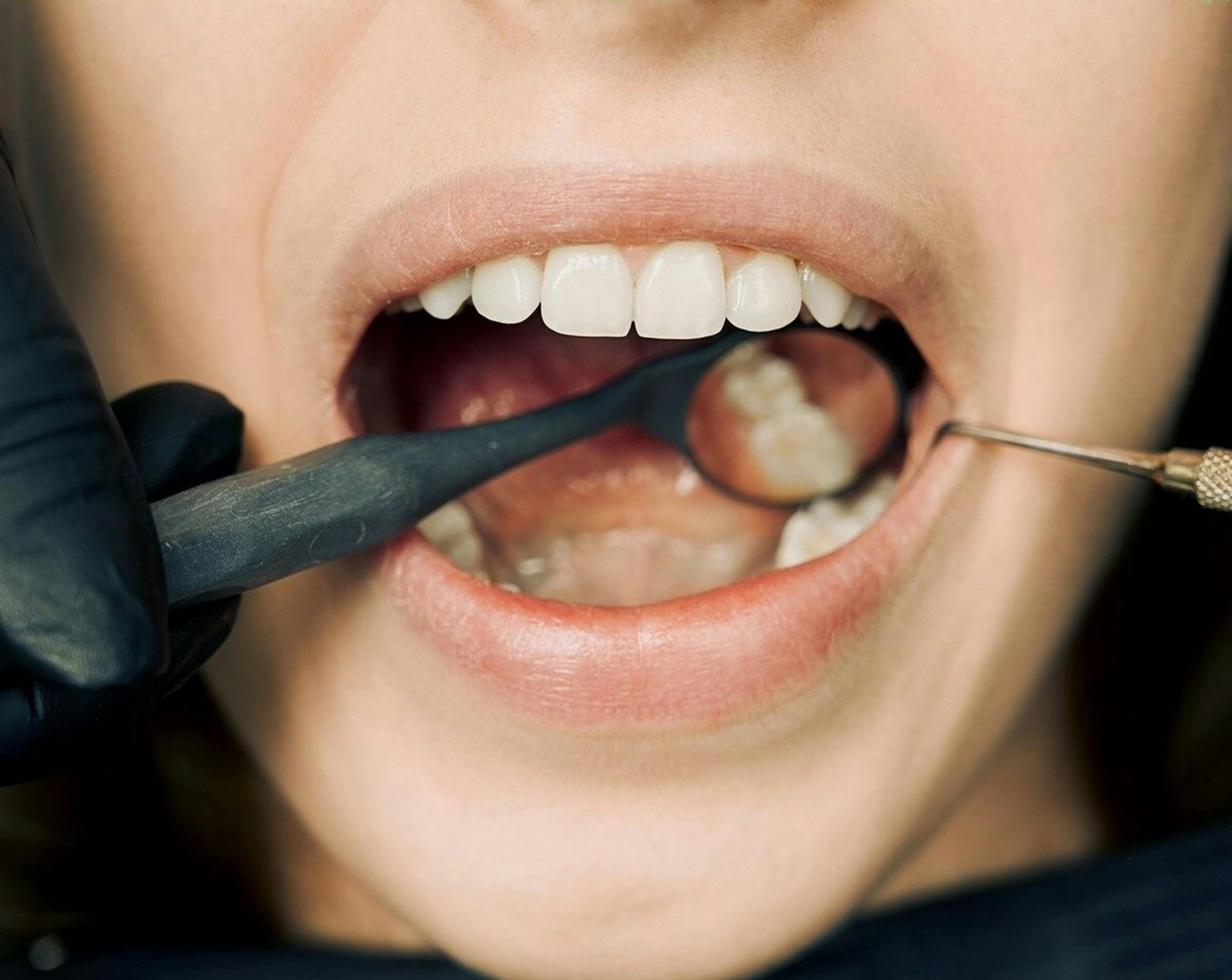 From Bleeding to Healing: Effective Ways to Manage Gum Disease