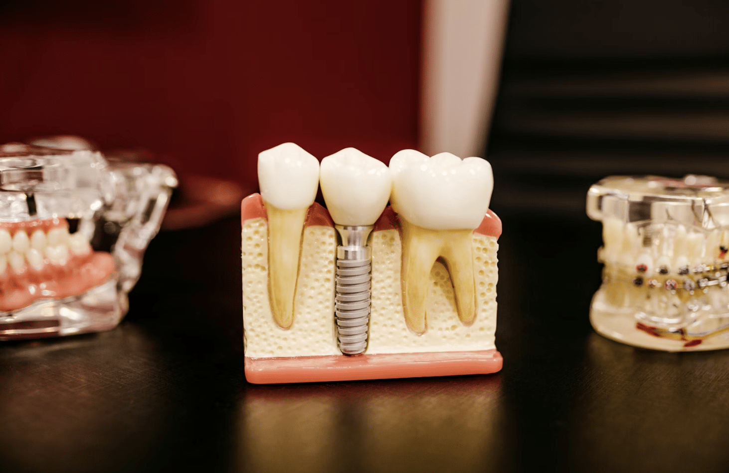 How Oral Health Influences Whole-Body Wellness More Than You Think