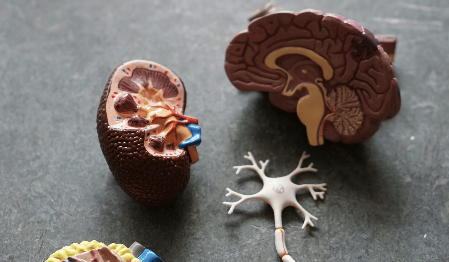 Hydration Hacks That Might Save You From Painful Kidney Stones